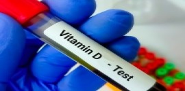 Maîtrise médicalisée : les biologistes se mobilisent pour faire baisser les prescriptions inutiles  de dosages de la vitamine D
