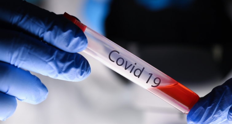 Rappel consignes DGS : Test RT-PCR SARS COV2  chez les professionnels de santé