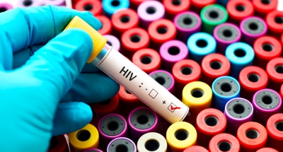Prévention : Généralisation du dépistage du VIH en laboratoire sans ordonnance