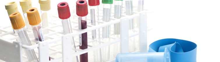 Examens urgents: nouvelles obligations pour les laboratoires de biologie médicale 